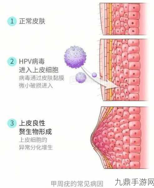 HPV感染与性接触关系解析，1. HPV感染：性接触背后的隐秘威胁